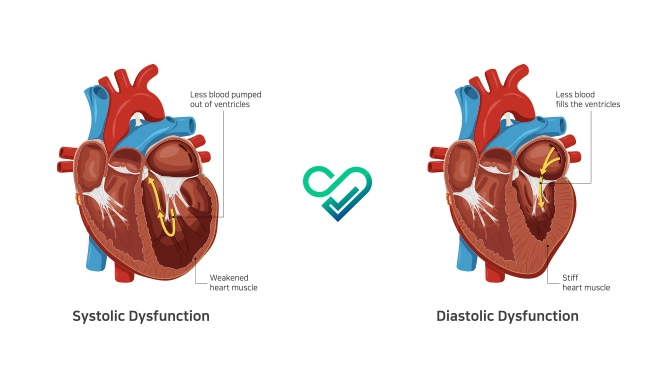 systolic vs diastolic heart failure